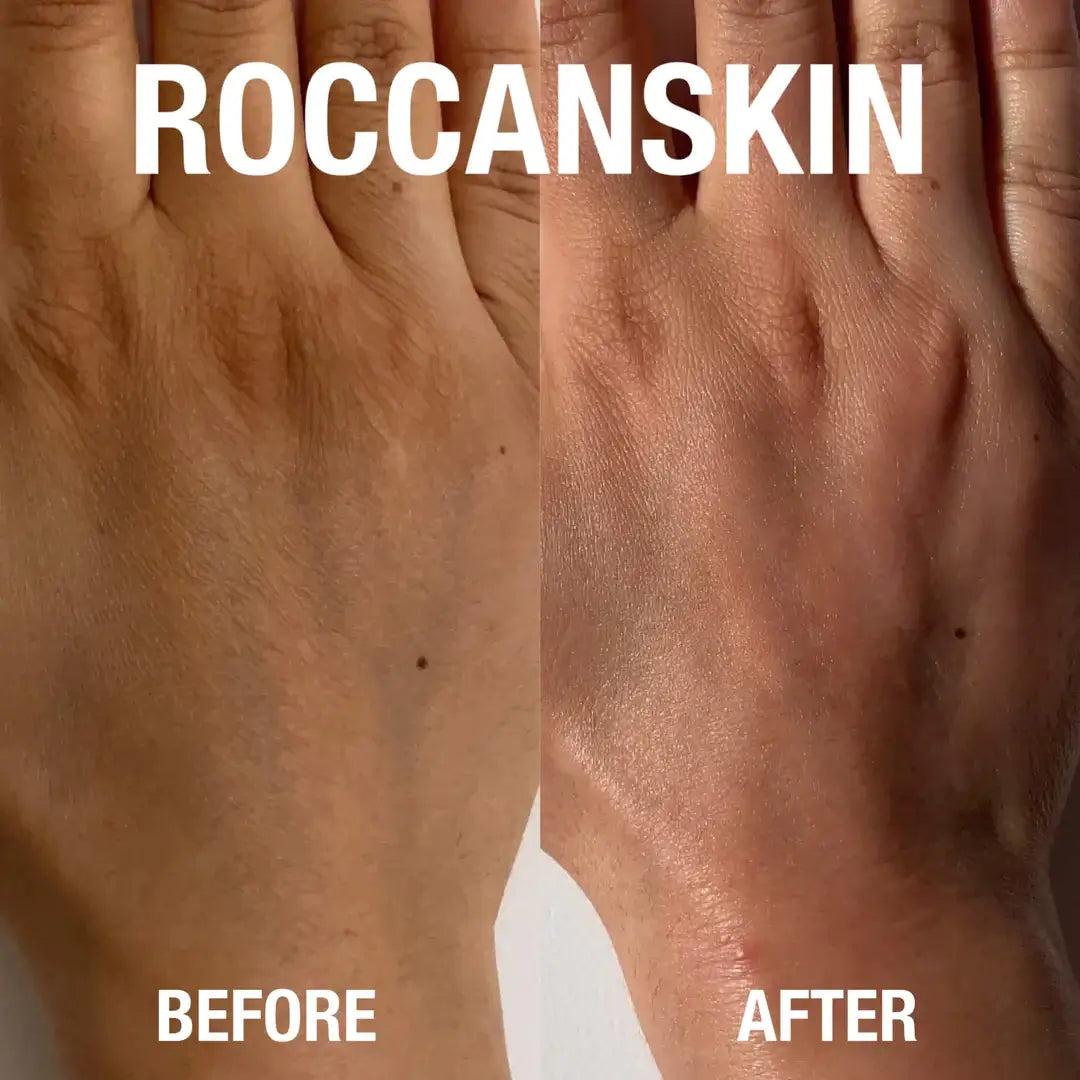 roccanskin exfoliating mitt. The best exfoliating mitt for dry skin, keratosis pilaris, ingrown hairs, breakouts, back acne, stretch marks, hyperpigmentation, eczema, psoriasis, fake tan remover. 